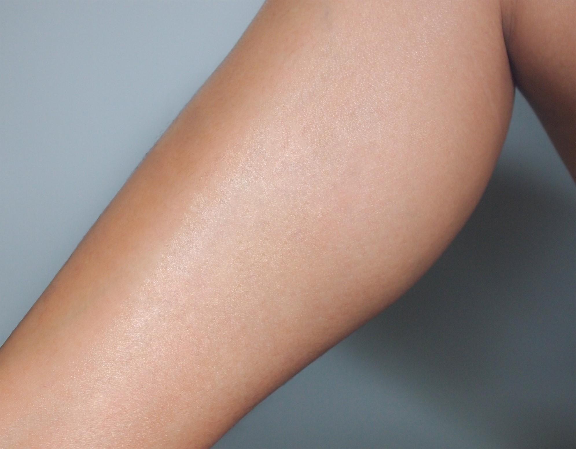 Smooth leg after laser hair removal