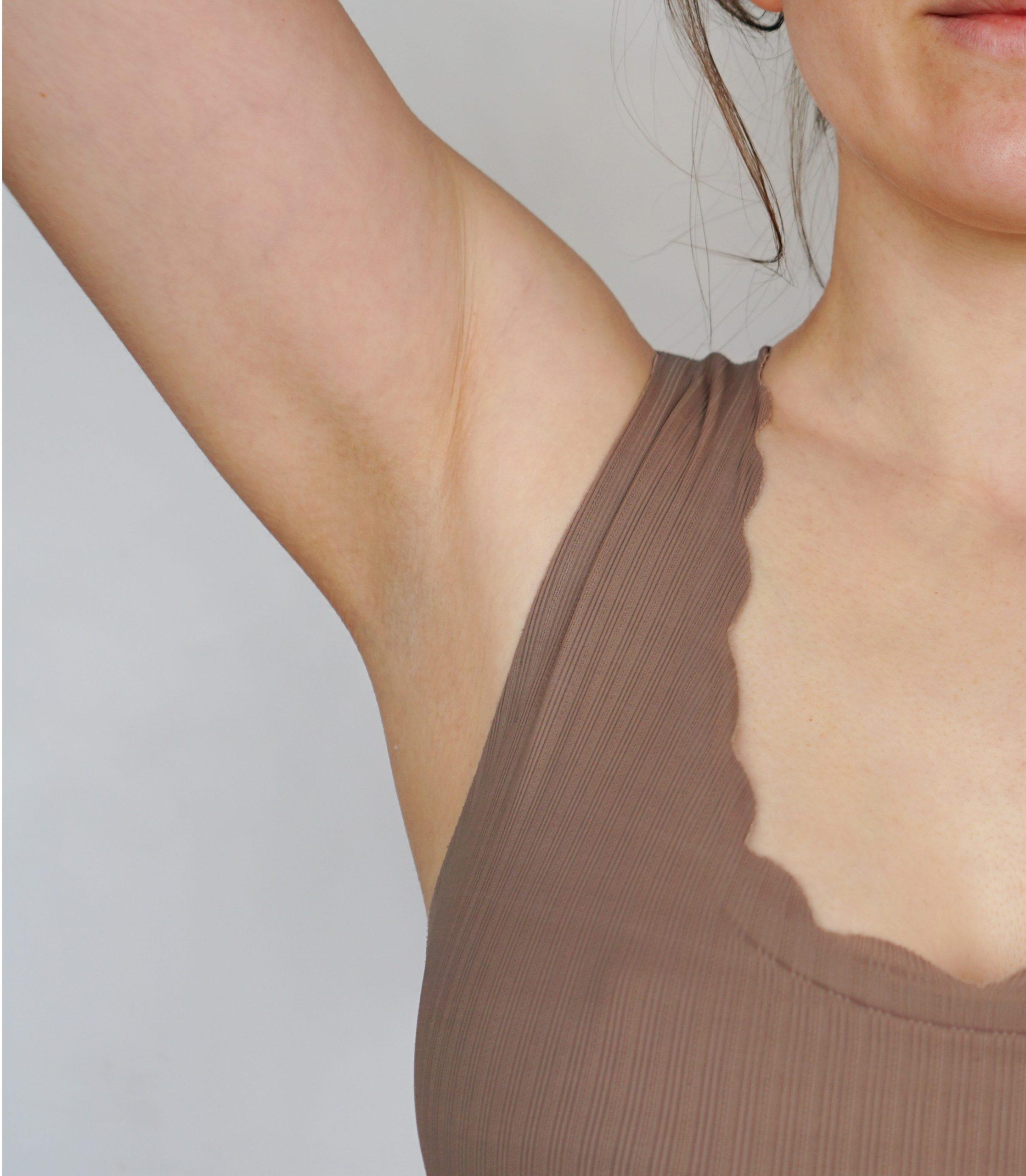 Armpit before laser hair removal treatment