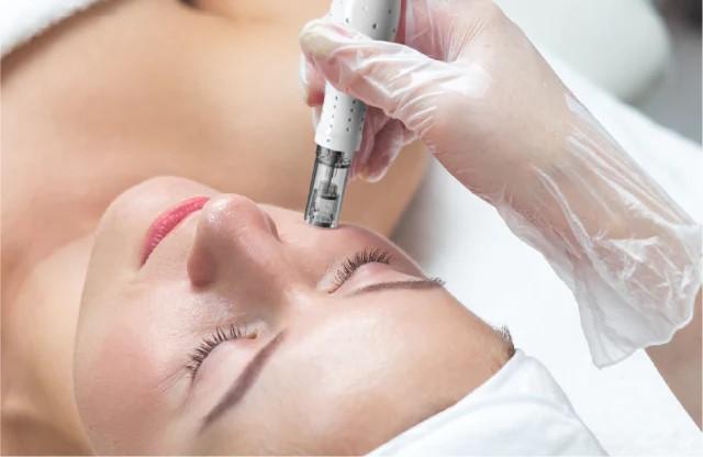 Microneedling imedpen